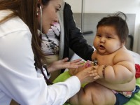 Un bebe colombiano pesa 21 kilos con sólo 8 meses de edad
